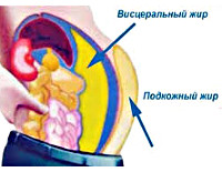 Абдоминальное ожирение